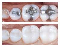 iCAMBIO EMPASTES