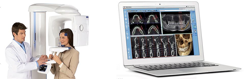 Clínica dental Valencia TAC Planmeca-3D-y-3Ds-7