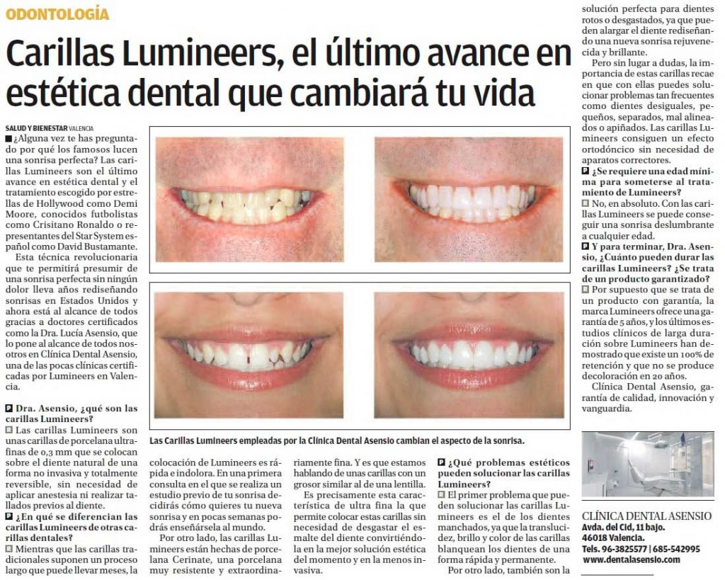 Publirreportaje de Clínica Asensio sobre Lumineers en el periódico Levante