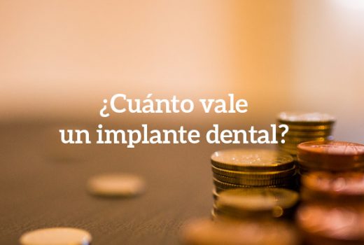 Precio de implantes dentales: La nueva sección web de Asensio