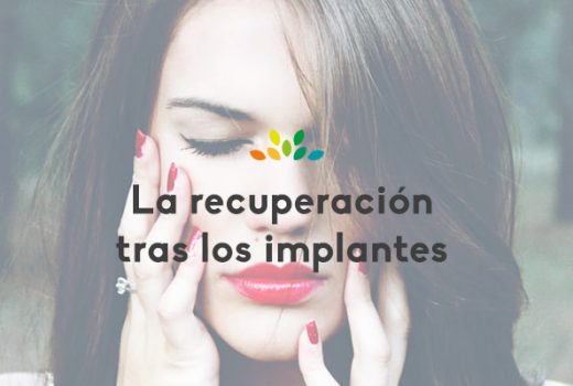 Los implantes dentales y el tiempo de recuperación.