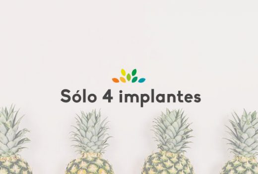 4 implantes que son para siempre