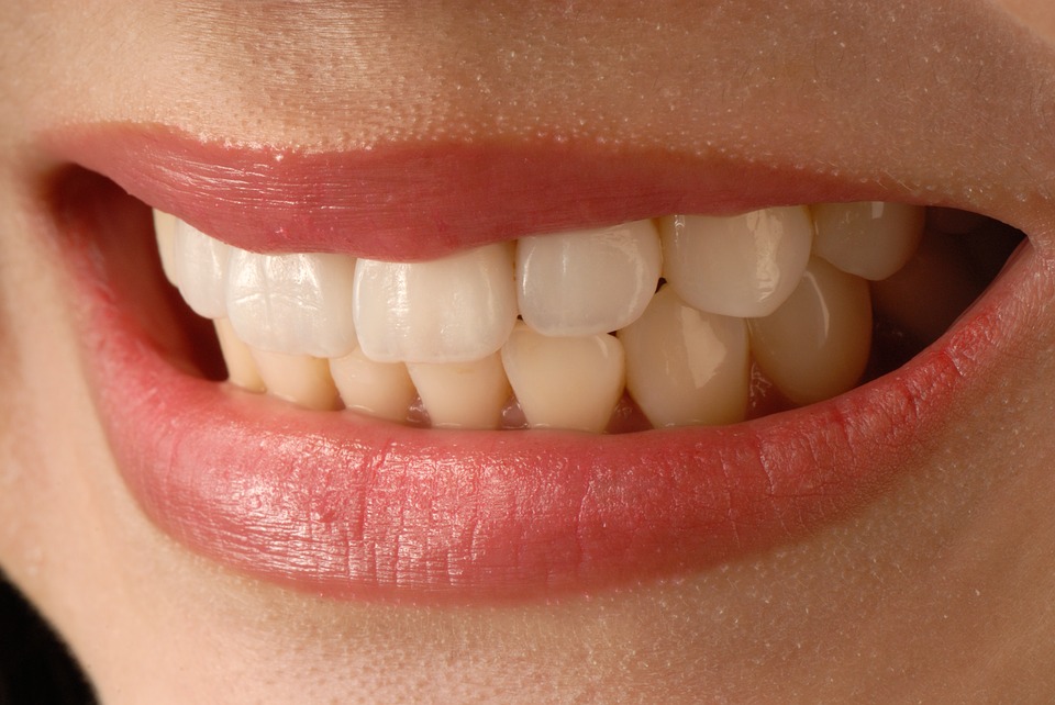Carillas dentales Dental Asensio, tu Clínica dental en Valencia. Dentista especialista en