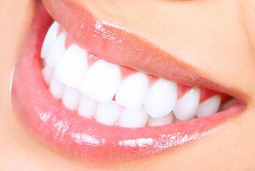 ¿Qué son los brackets invisibles? Tipos y ventajas