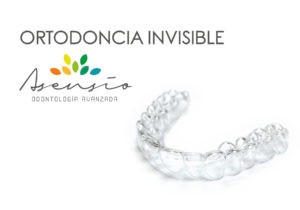 ortodoncia invisible invisalign en valencia