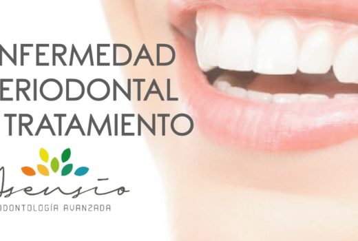 ¿Qué es la periodoncia, enfermedad periodontal y su tratamiento?