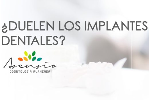 ¿Dueles los implantes dentales?