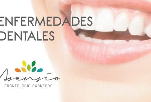 ENFERMEDADES DENTALES. PERIODONTITIS Y SUS OTROS SINTOMAS