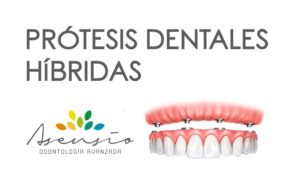 protesis hibridas dentales en valencia