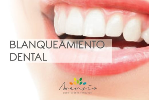 ¿QUÉ ES EL BLANQUEAMIENTO DENTAL?