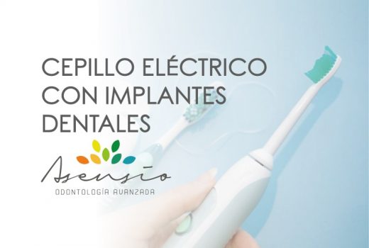 Si tengo implantes dentales… ¿Qué cepillo de dientes debería utilizar?