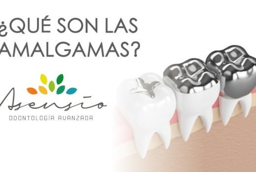 ¿Qué son las amalgamas dentales?