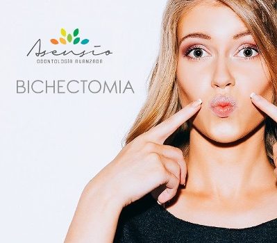 ¿En qué consiste la Bichectomía?