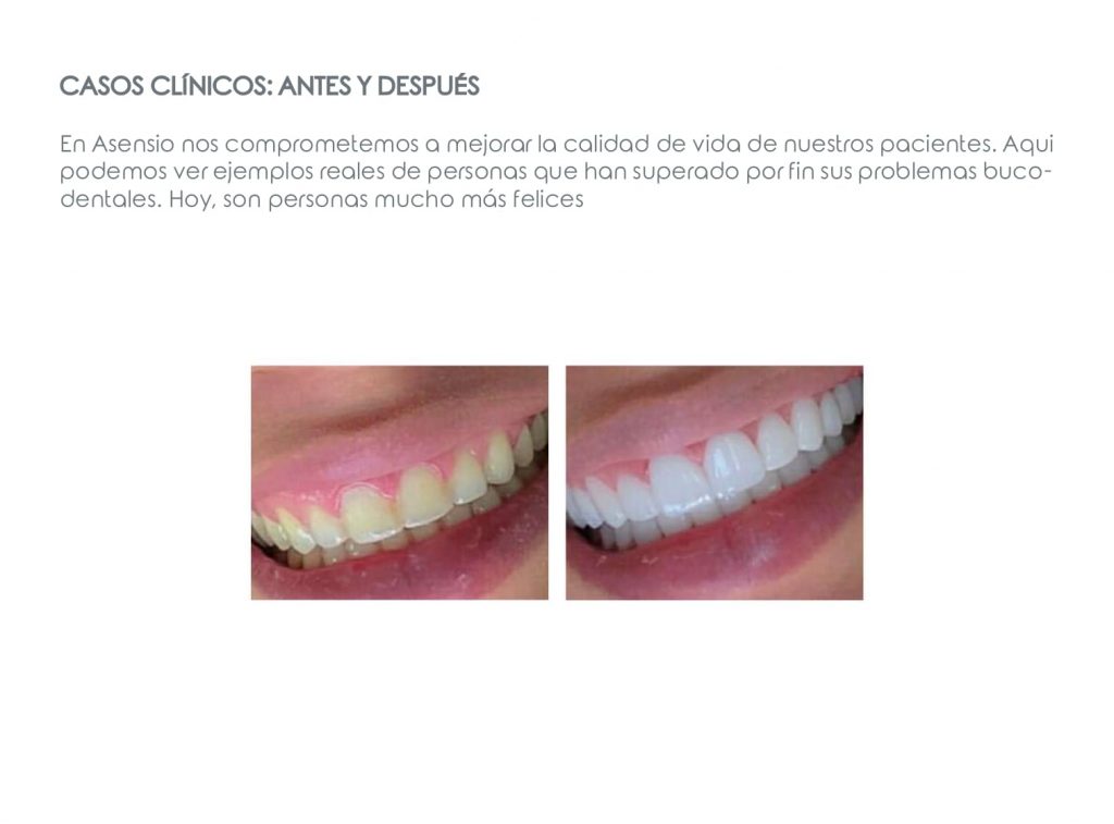 Casos clinicos de antes y despues