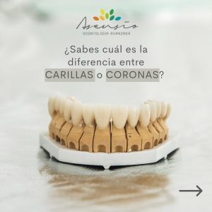 carillas dentales en valencia