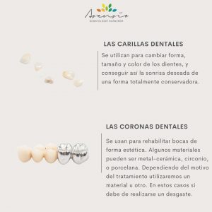 coronas dentales en valencia