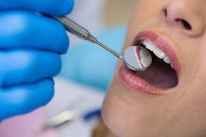 تمیز کردن دندان در کلینیک دندانپزشکی والنسیا