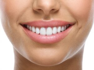 blanqueador dental que es clínica dental valencia