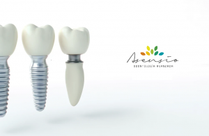 Presupuesto y precio implante dental de 3 piezas en Valencia